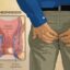 How to Get Rid Of Your Piles And Constipation